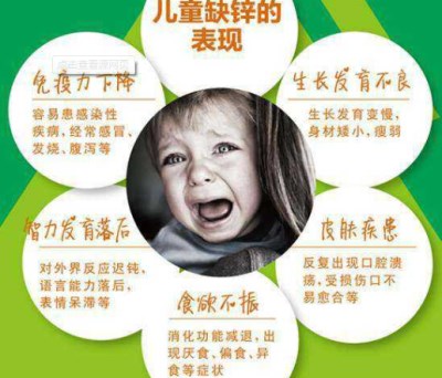 全自动星空体育解析缺锌到底会不会引起缺陷-山东国康