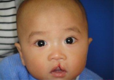 全自动星空体育解析缺锌到底会不会引起缺陷-山东国康 全自动星空体育解析缺锌到底会不会引起缺陷-山东国康