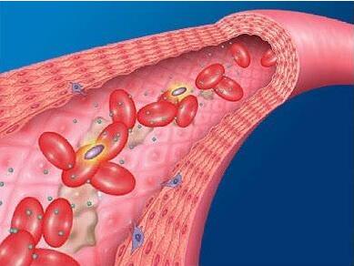 【小满来了】!医用星空体育厂家提供几种食物清除你的血液垃圾!